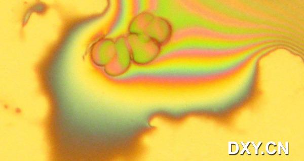这张色彩斑斓的图仿佛是很多肥皂泡，其实是一滴血的超微观图，血滴被放大了2000倍