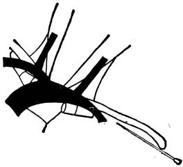 经锁骨下入径穿刺锁骨下静脉