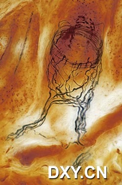 毛囊感觉神经末梢