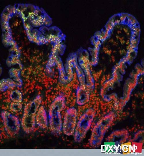 小肠绒毛，共聚焦显微镜