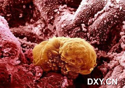 培育6天后的人类胚胎被植入子宫