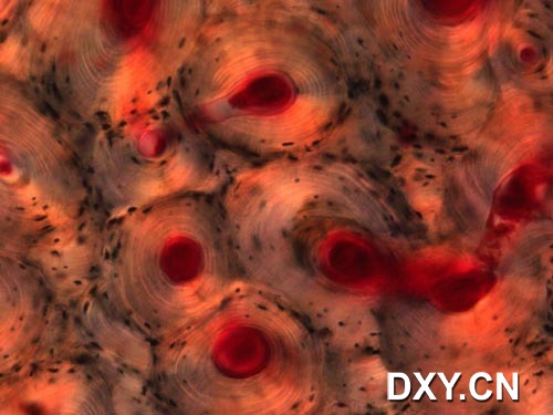 人体股骨的密质骨骼