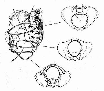 骨盆腔三个面示意图