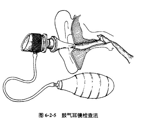 鼓气耳镜检查.jpg