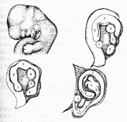 耳廓的发生