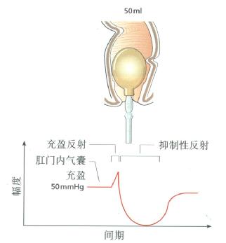 直肠气囊充盈引出的正常RAIR