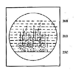 仪器监测屏上显示白细胞通过脉冲