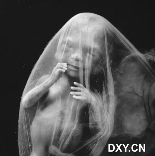 胎儿已生长至大约20厘米长