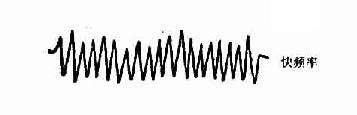 快呼吸频率
