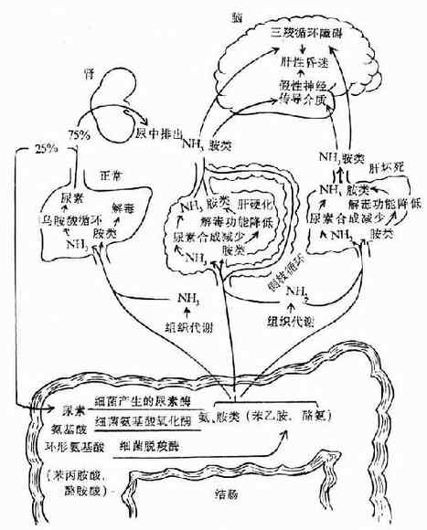 正常人和肝性脑病患者的氨及胺类代谢示意图