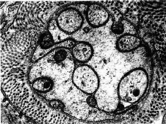 大鼠无髓神经纤维横切电镜像