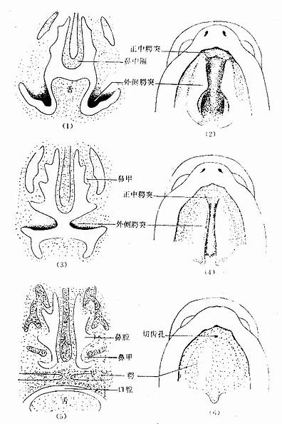 腭的发生及口腔与鼻腔的分隔