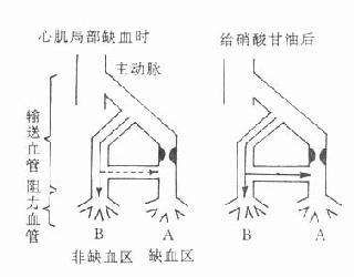 硝酸甘油对冠状动脉的作用部位示意图
