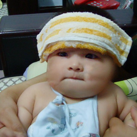 文件:婴幼儿发热.jpg
