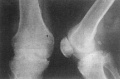 Guwcp9jp.jpg