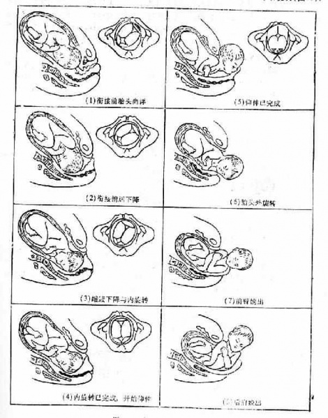 文件:Gkpd4r0i.jpg