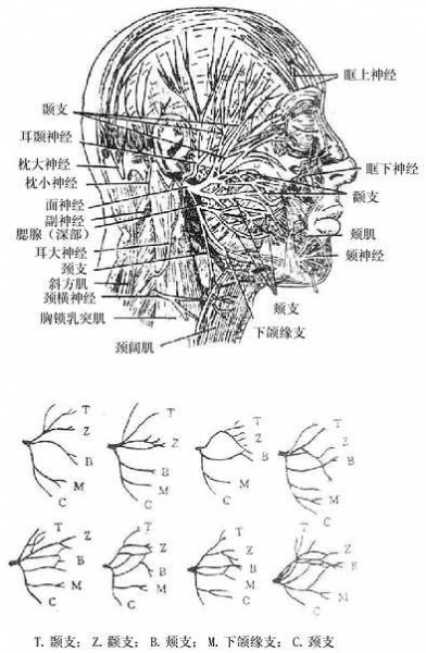 文件:Gm7bduzl.jpg