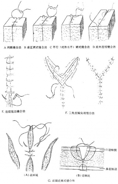 文件:Gmipbtff.jpg