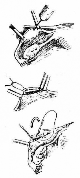 文件:Gkpiclbn.jpg