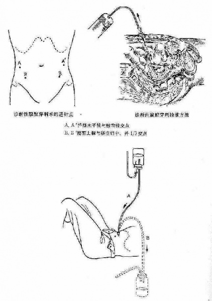文件:Gl90zybd.jpg