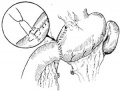 Bka35.jpg