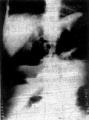Guwf45qx.jpg