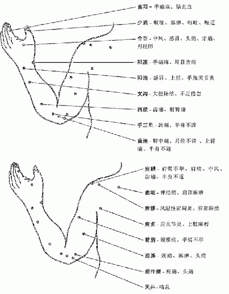 文件:X shangzhi2.gif