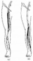 Gl91p4i1.jpg