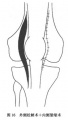 Gxq1j3nj.jpg