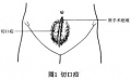 Gxptx972.jpg