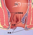 Bkm3a.jpg