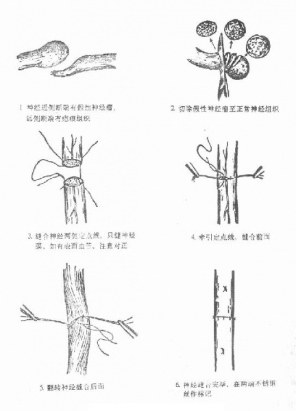 文件:Gkrwc2a9.jpg
