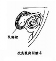 2014年1月18日 (六) 15:32的版本的缩略图