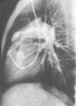 Bka92.jpg